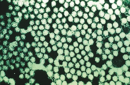 Hình ảnh virus lở mồm long móng (FMDV) chụp dưới kính hiển vi điện tử